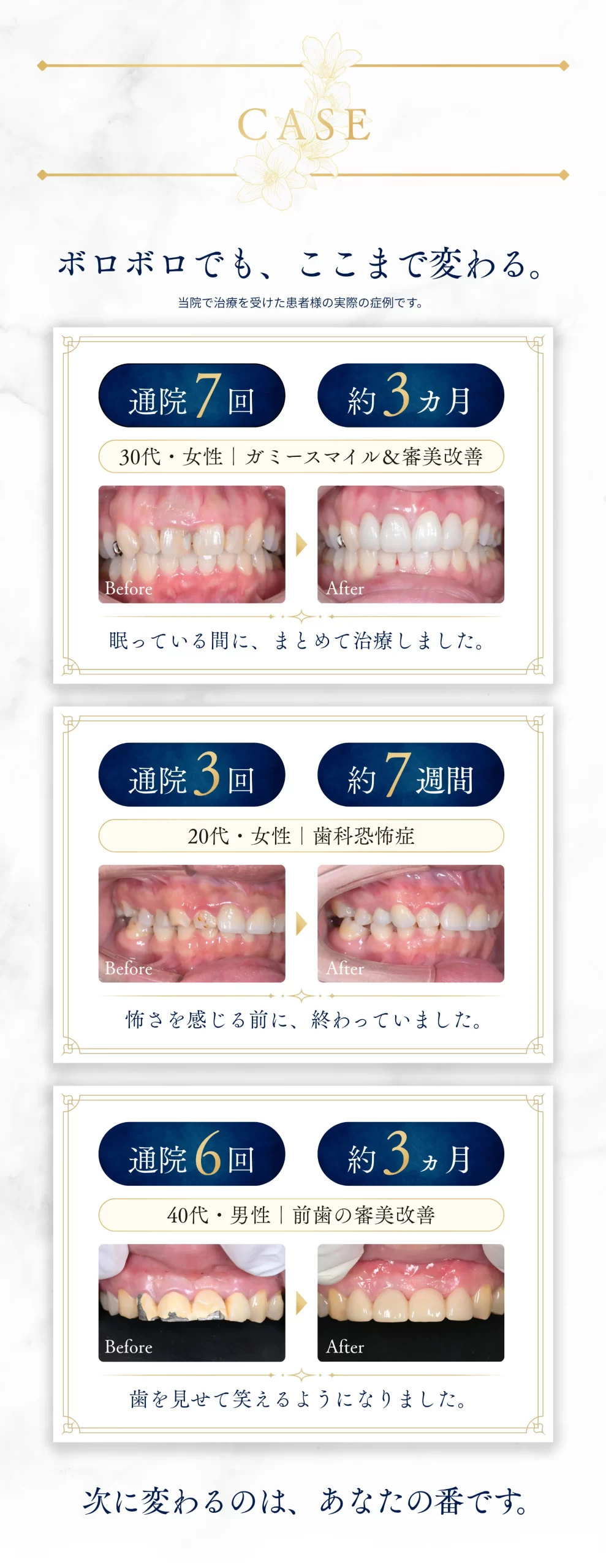 CASE(SP)